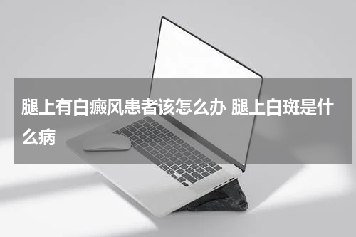腿上有白癜风患者该怎么办 腿上白斑是什么病