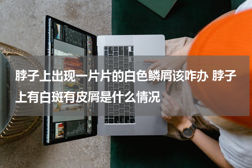 脖子上出现一片片的白色鳞屑该咋办 脖子上有白斑有皮屑是什么情况
