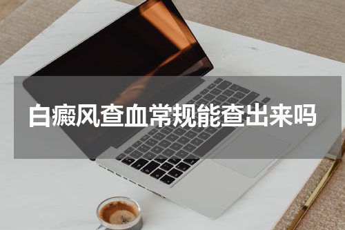 白癜风查血常规能查出来吗