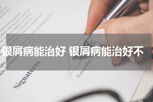 银屑病能治好 银屑病能治好不