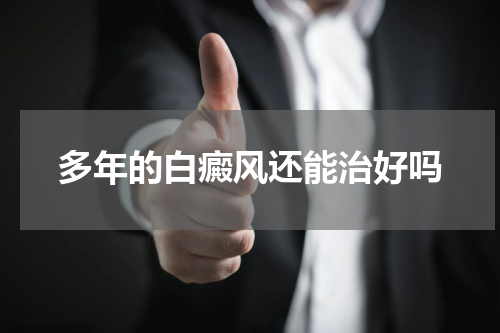 多年的白癜风还能治好吗
