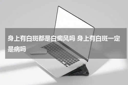 身上有白斑都是白癜风吗 身上有白斑一定是病吗