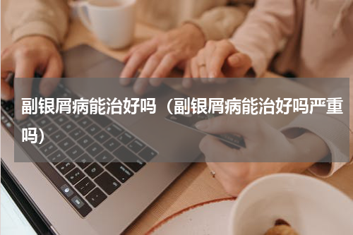副银屑病能治好吗（副银屑病能治好吗严重吗）