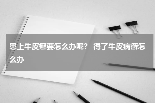 患上牛皮癣要怎么办呢？ 得了牛皮病癣怎么办