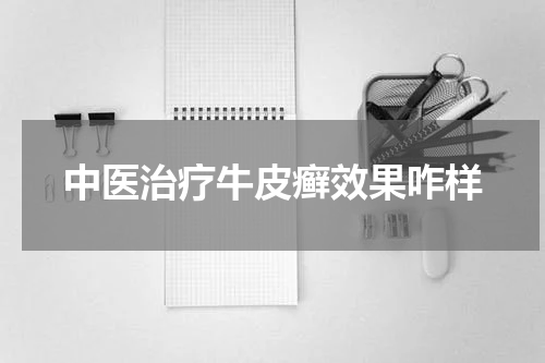 中医治疗牛皮癣效果咋样