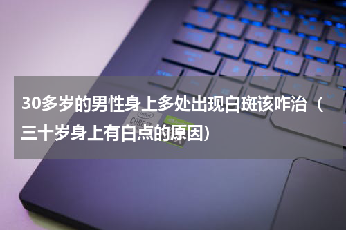 30多岁的男性身上多处出现白斑该咋治（三十岁身上有白点的原因）