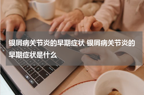 银屑病关节炎的早期症状 银屑病关节炎的早期症状是什么