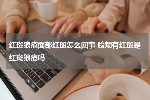 红斑狼疮面部红斑怎么回事 脸颊有红斑是红斑狼疮吗
