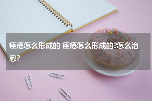 痤疮怎么形成的 痤疮怎么形成的?怎么治愈?