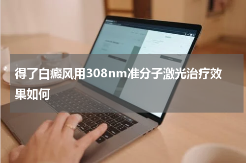 得了白癜风用308nm准分子激光治疗效果如何