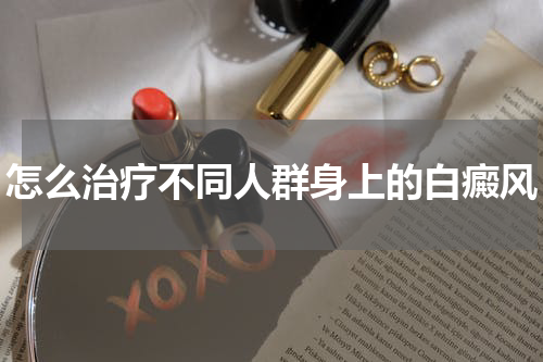 怎么治疗不同人群身上的白癜风