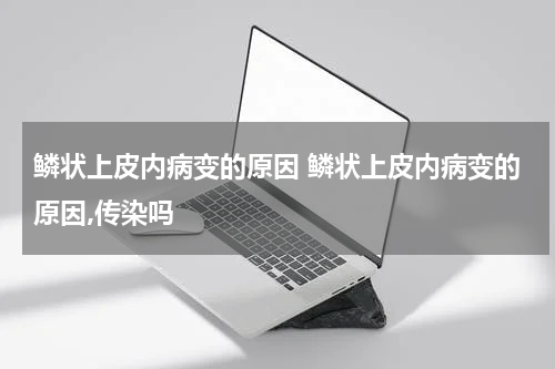 鳞状上皮内病变的原因 鳞状上皮内病变的原因,传染吗