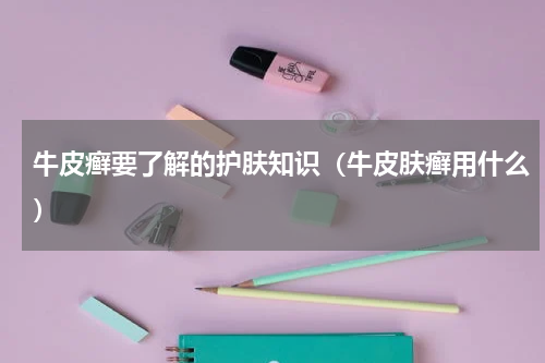 牛皮癣要了解的护肤知识（牛皮肤癣用什么）