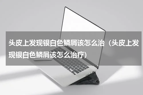 头皮上发现银白色鳞屑该怎么治（头皮上发现银白色鳞屑该怎么治疗）