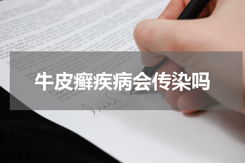 牛皮癣疾病会传染吗