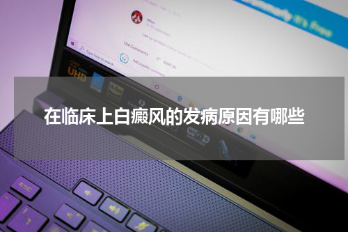 在临床上白癜风的发病原因有哪些
