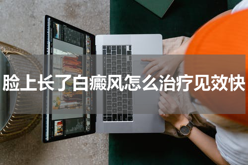 脸上长了白癜风怎么治疗见效快