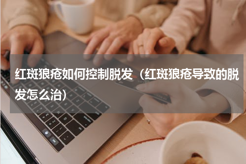 红斑狼疮如何控制脱发（红斑狼疮导致的脱发怎么治）