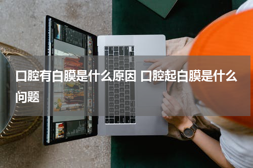 口腔有白膜是什么原因 口腔起白膜是什么问题