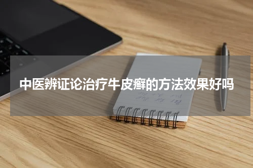 中医辨证论治疗牛皮癣的方法效果好吗
