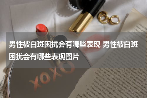 男性被白斑困扰会有哪些表现 男性被白斑困扰会有哪些表现图片