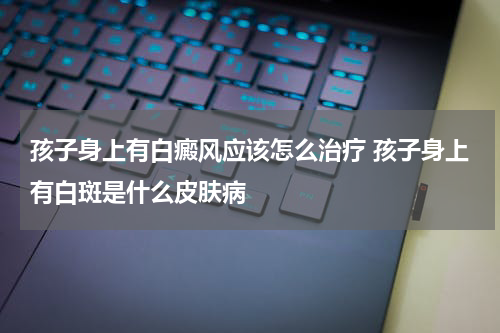 孩子身上有白癜风应该怎么治疗 孩子身上有白斑是什么皮肤病
