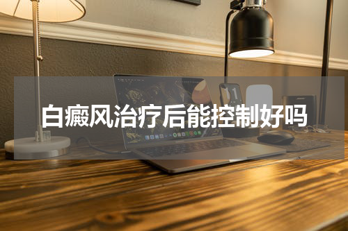 白癜风治疗后能控制好吗