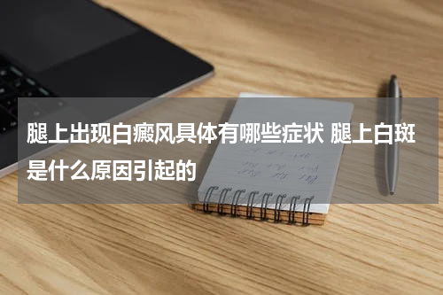 腿上出现白癜风具体有哪些症状 腿上白斑是什么原因引起的