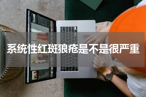 系统性红斑狼疮是不是很严重