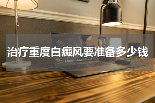 治疗重度白癜风要准备多少钱
