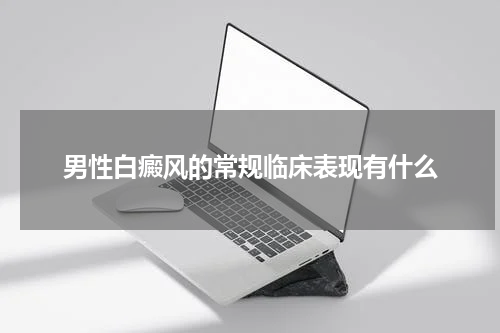 男性白癜风的常规临床表现有什么