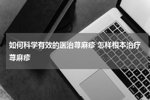 如何科学有效的医治荨麻疹 怎样根本治疗荨麻疹