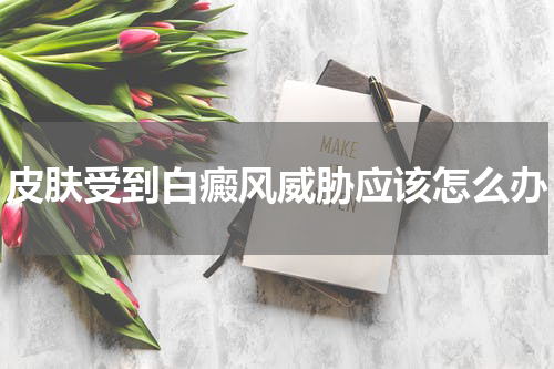 皮肤受到白癜风威胁应该怎么办