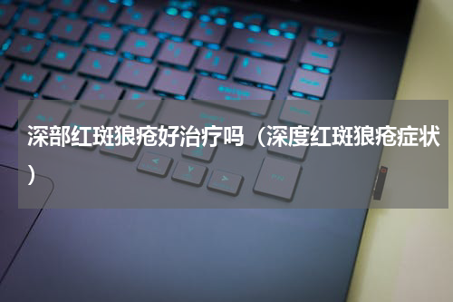 深部红斑狼疮好治疗吗（深度红斑狼疮症状）