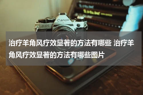 治疗羊角风疗效显著的方法有哪些 治疗羊角风疗效显著的方法有哪些图片