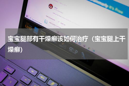 宝宝腿部有干燥癣该如何治疗（宝宝腿上干燥癣）