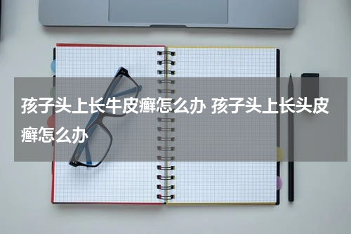 孩子头上长牛皮癣怎么办 孩子头上长头皮癣怎么办