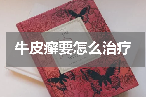 牛皮癣要怎么治疗