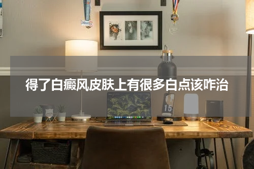 得了白癜风皮肤上有很多白点该咋治