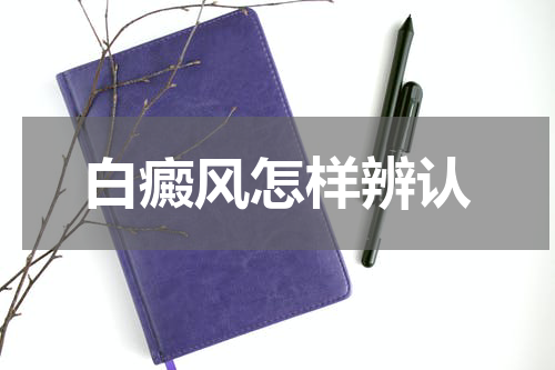 白癜风怎样辨认