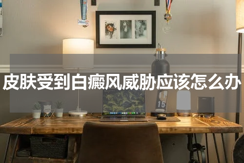 皮肤受到白癜风威胁应该怎么办