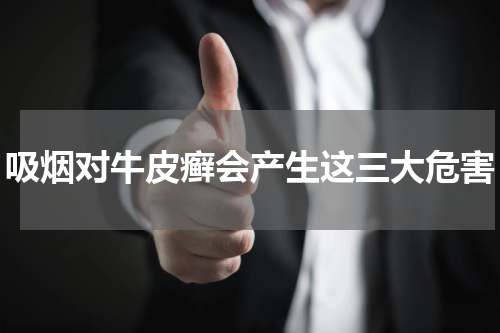 吸烟对牛皮癣会产生这三大危害
