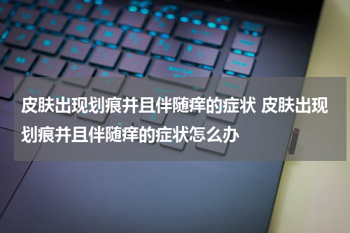皮肤出现划痕并且伴随痒的症状 皮肤出现划痕并且伴随痒的症状怎么办