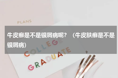 牛皮癣是不是银屑病呢？（牛皮肤癣是不是银屑病）