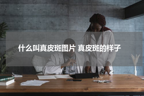什么叫真皮斑图片 真皮斑的样子