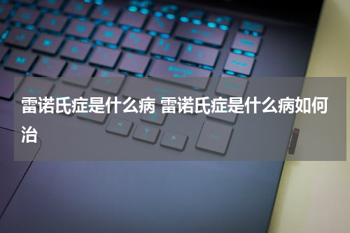 雷诺氏症是什么病 雷诺氏症是什么病如何治