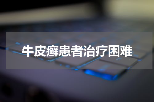 牛皮癣患者治疗困难