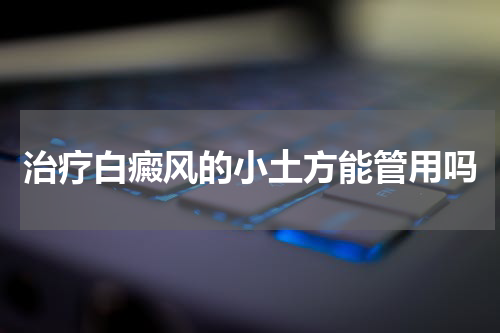 治疗白癜风的小土方能管用吗