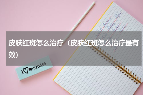 皮肤红斑怎么治疗（皮肤红斑怎么治疗最有效）