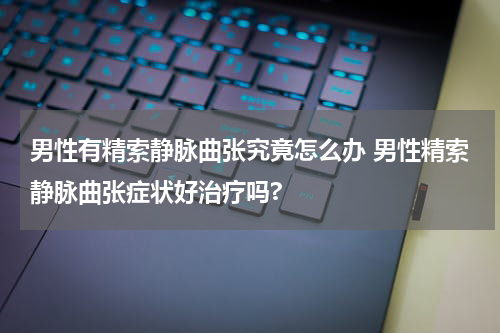 男性有精索静脉曲张究竟怎么办 男性精索静脉曲张症状好治疗吗?